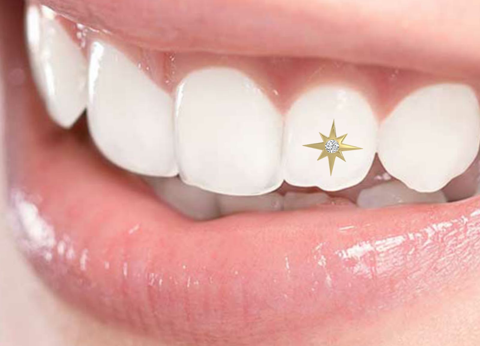 Twinkles 24K Yellow Gold Tooth Gems Small Star